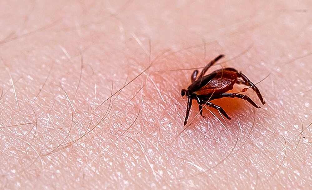 forstarbeiter-tipps-zecken-zeckenbisse-gefahr-krankheiten-fsme-borreliose-schutz-forstarbeit-fsme